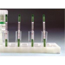 ToMV AgriStrip Teststreifen, VE 25 Tests | Hornik